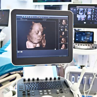ultrasound